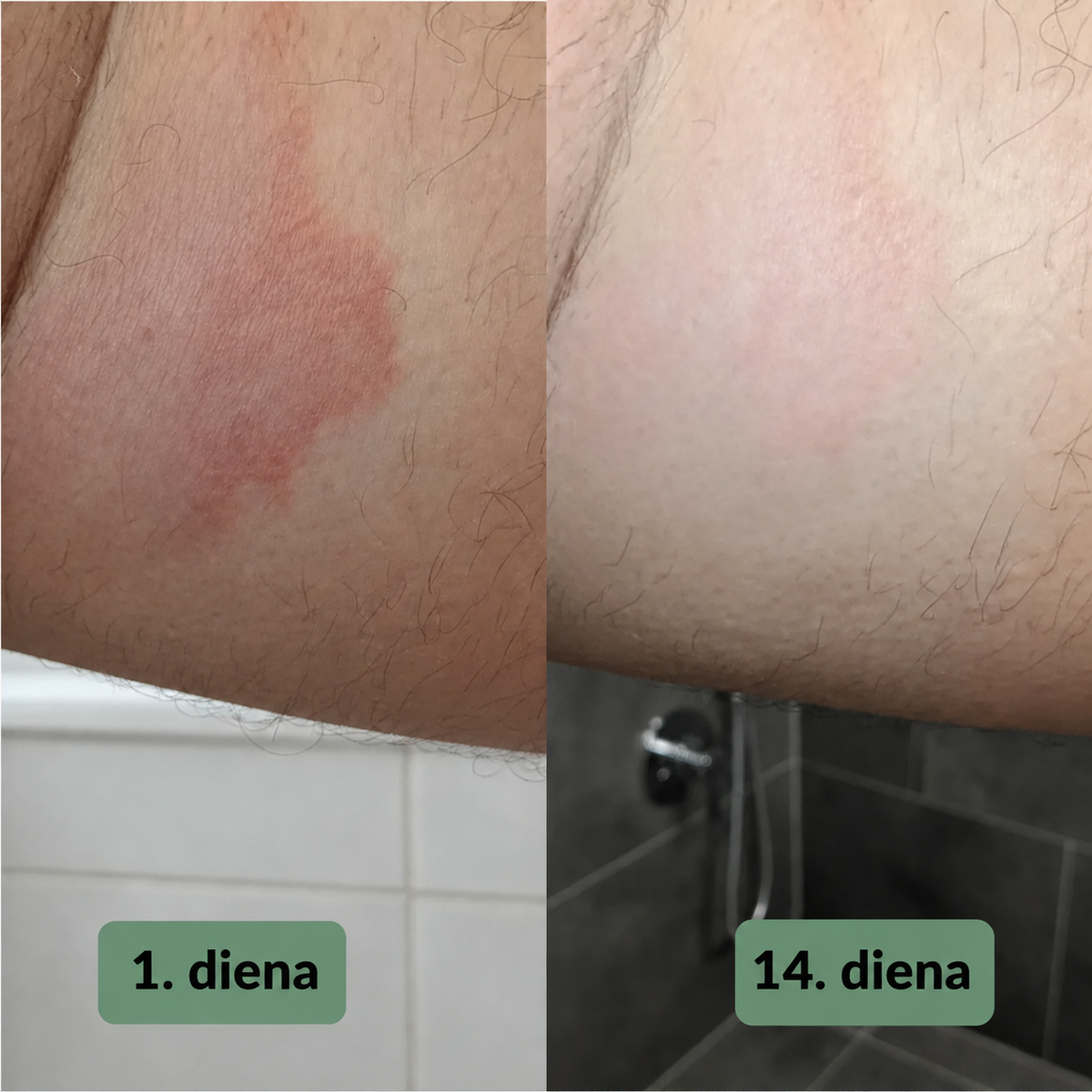 Vuneva nomierinošās ziepes