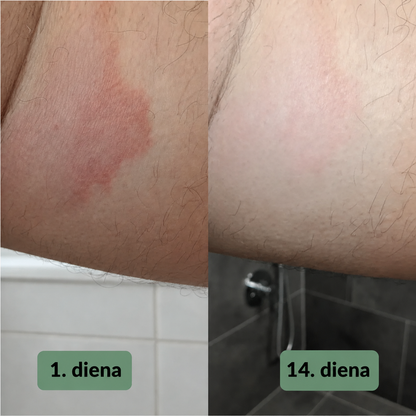 Vuneva nomierinošās ziepes