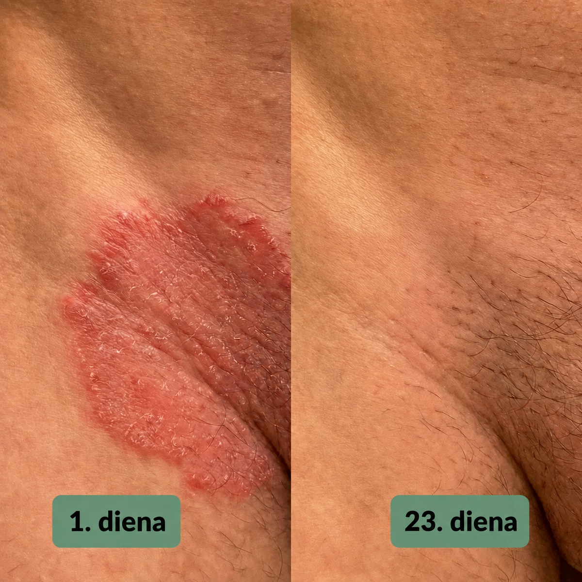 Vuneva nomierinošās ziepes
