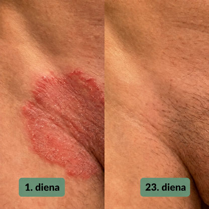 Vuneva nomierinošās ziepes